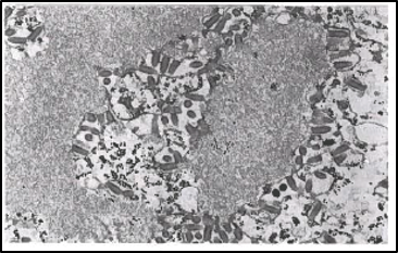 microscopic image of rabies